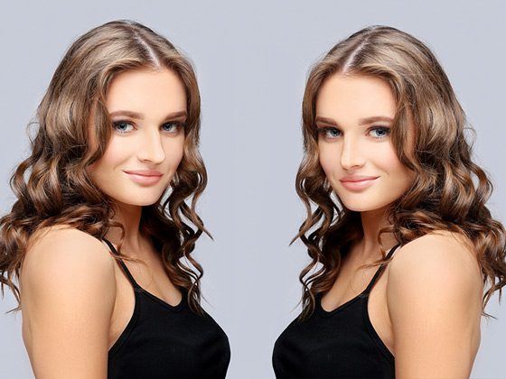 Lifting facial: resultado de rejuvenecimiento del rostro y cuello con cirugía de estiramiento (imagen ilustrativa)