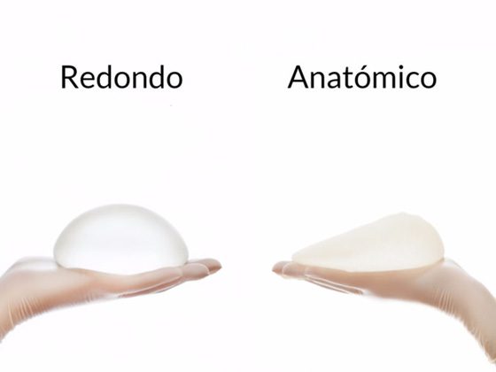 cual es la forma de los implantes de gluteo