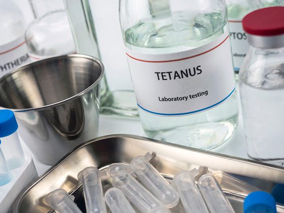 la toxina botulinica ocasiona tetanos 2
