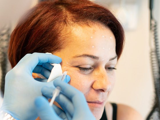 que es la toxina botulinica 2