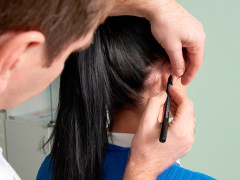 Reconstruccion de oreja lesionada 3