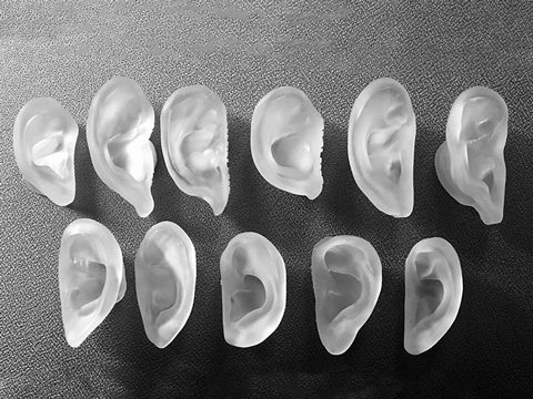 alteracion congenita de la oreja 5