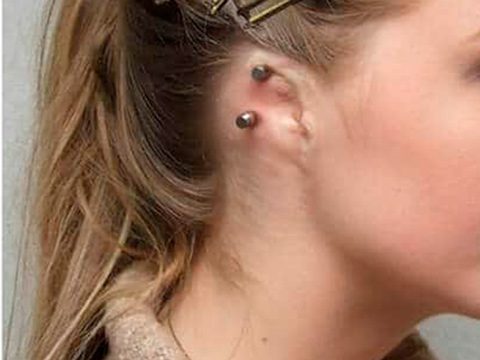 alteracion congenita de la oreja 6