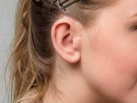 alteracion congenita de la oreja 7