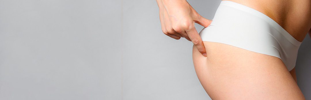 se absorbe la grasa que se coloca en gluteos 1