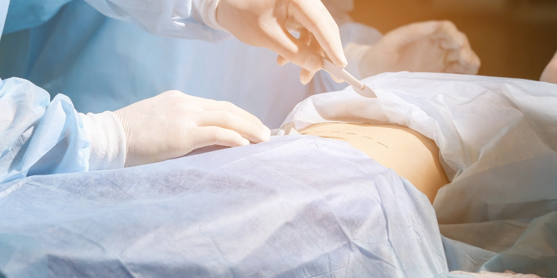 Evaluación médica preoperatoria de la paciente